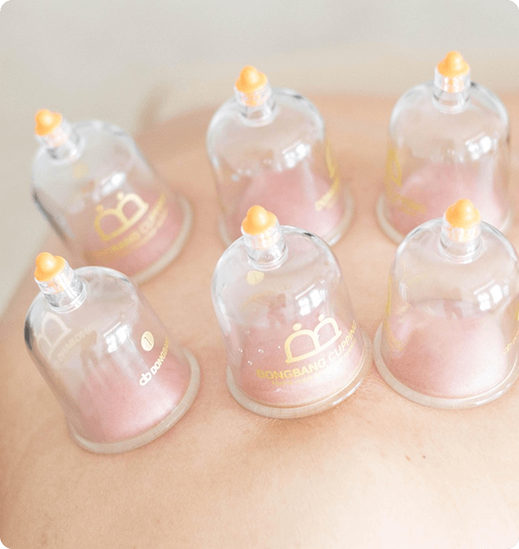 Cupping therapy Toronto Spa
