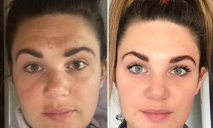 HydraFacial treatment at Pamper Valley spa in downtown Toronto