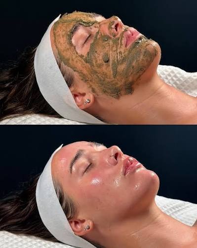 Before and after a Marine Herb Peel facial at Pamper Valley spa in Toronto